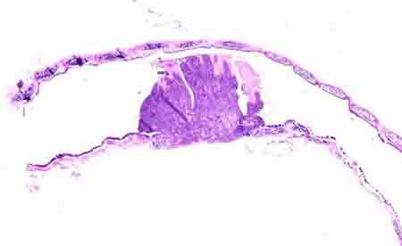 Hamster Cancer Cell